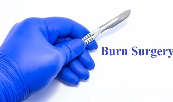 Burn Surgery in Bhubaneswar