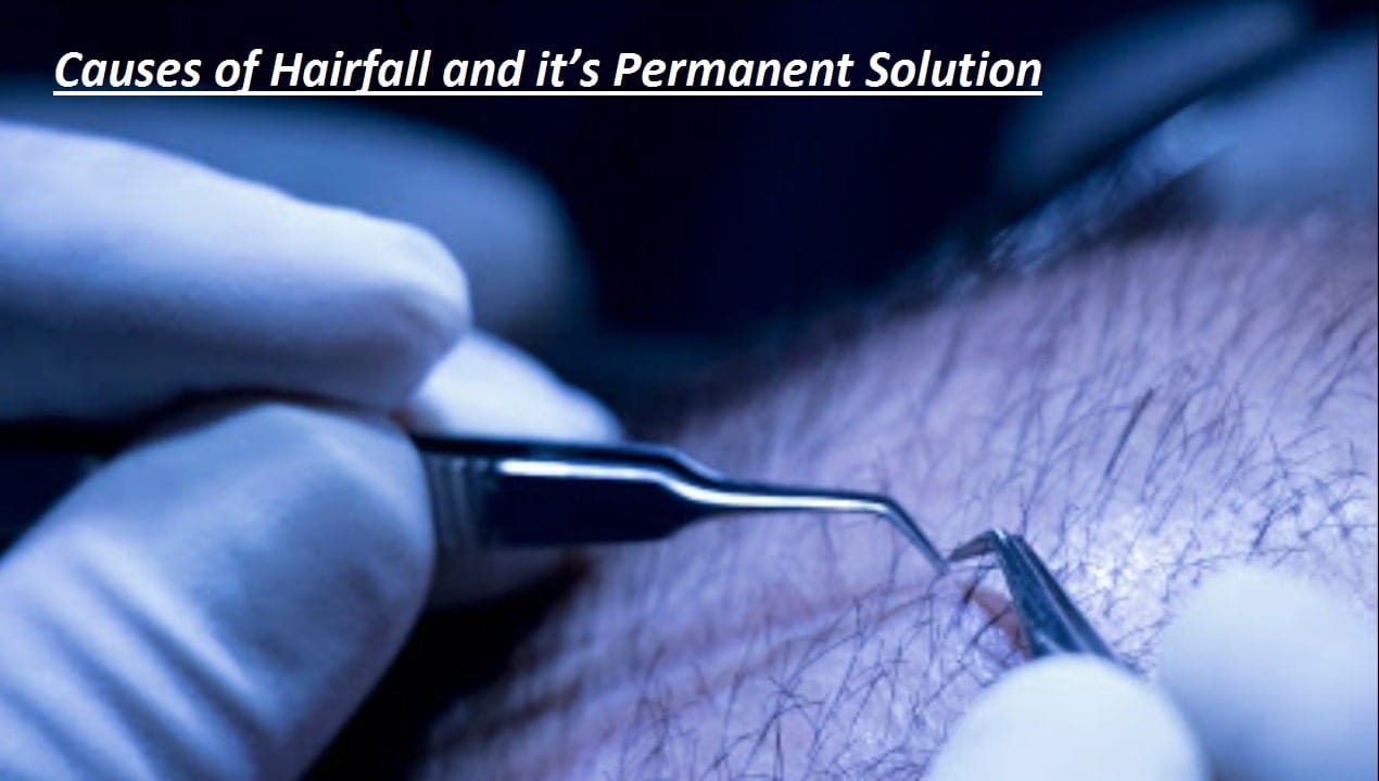 Causes of Hairfall and it’s Permanent Solution