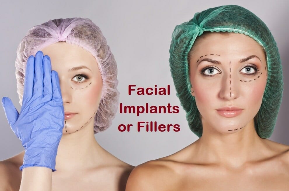 Facial Implants or Fillers: How Do I Decide