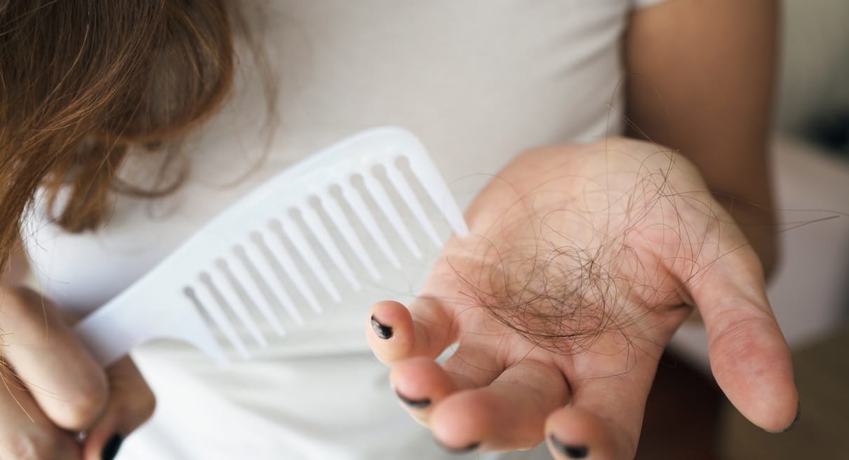Is Losing Huge number of Hairs a Day Normal?
